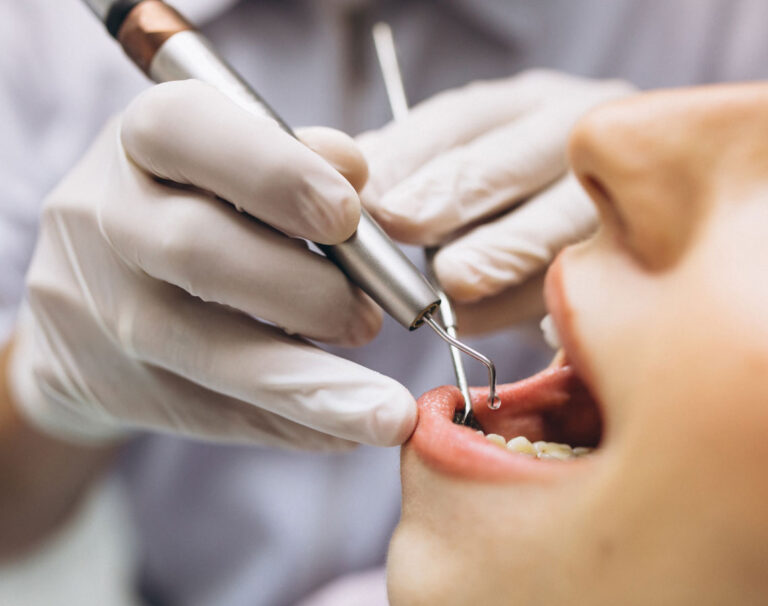 Endodonti Tedavisi Nedir